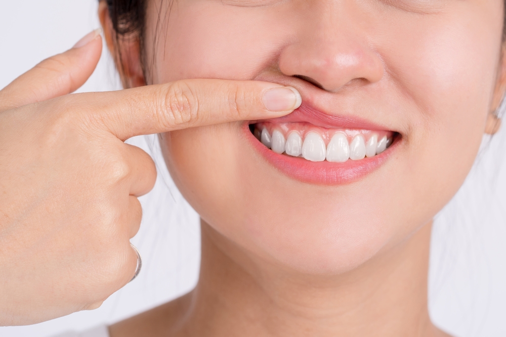 Overview of Implant Placement