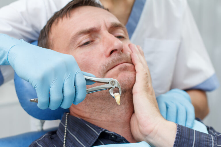 Tooth Extractions loveland